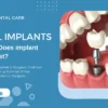 Cost Of Dental Implants In Gurgaon