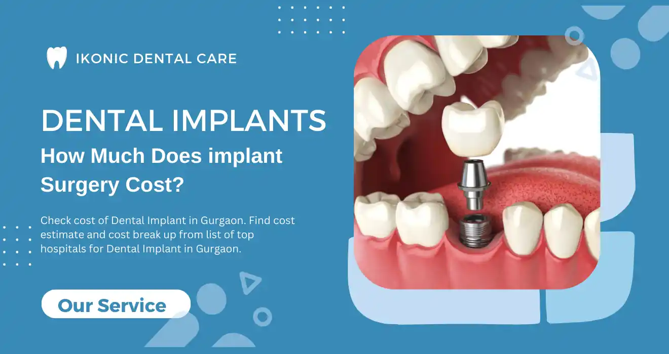 Cost Of Dental Implants In Gurgaon